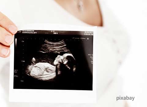 育婴论坛：要想宝宝不畸形 孕初期5件事须注意